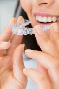 Invisalign