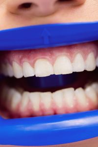 periodontoloji