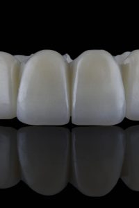 beautiful dental prosthesis made of precise dental polymer, shot on a black background with reflection