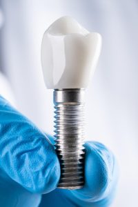 implant tedavisi
